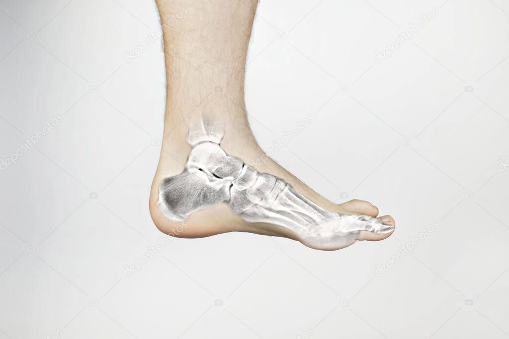 Conceptual photo. X-ray of a man foot. On the skin of the patient foot, it was as if an image of the heels, calcaneus, scaphoid, metatarsals and medial bone. View of bones through the skin. Isolated