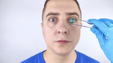 Göz kristal lens değişiminin kavramsal görüntüsü. Ototimik cerrahi. Görüş alanına geri dön. Kataraktların çıkarılması. Gözüne cerrahi müdahale. Doktor implantı hastanın yanında tutuyor.