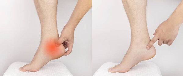До и после. Слева человек цепляется за больную пятку. Справа мужская боль исчезла, и врачи излечили ее. Шпора каблука, напряжение мышц, повреждение сухожилий или микротрещины