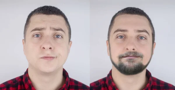 Left Man Facial Hair Right Guy Has Grown Beard Mustache — Stock Photo, Image