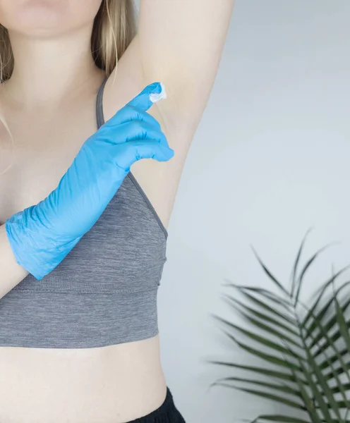 Mavi Eldivenli Bir Kız Koltukaltına Botulinyum Toksin Sürmüş Kozmetik Tıp — Stok fotoğraf