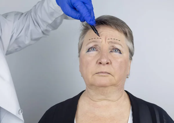Μια Ηλικιωμένη Γυναίκα Στην Υποδοχή Ενός Πλαστικού Προσώπου Χειρουργού Διαβούλευση — Φωτογραφία Αρχείου