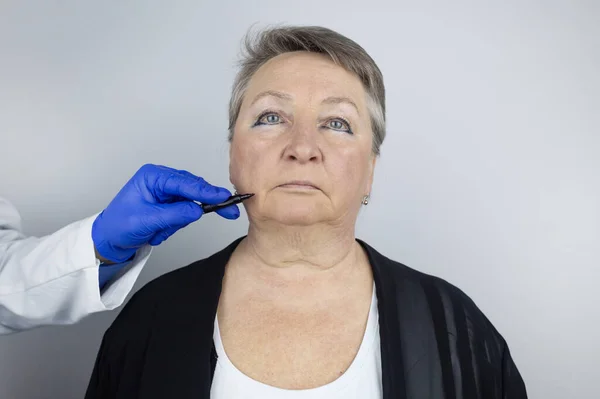 Elderly Woman Reception Facial Plastic Surgeon Consultation Removal Age Wrinkles — Stock Photo, Image