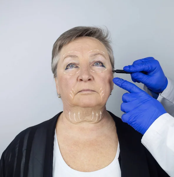Una Anciana Recepción Cirujano Plástico Facial Consulta Sobre Eliminación Las —  Fotos de Stock