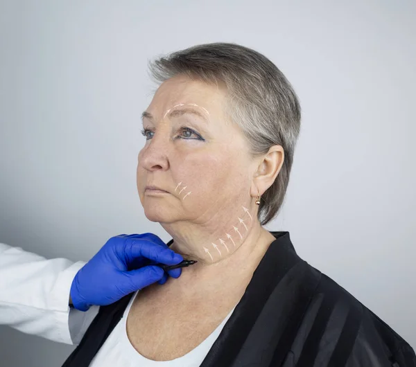 Elderly Woman Reception Facial Plastic Surgeon Consultation Removal Age Wrinkles — Stock Photo, Image