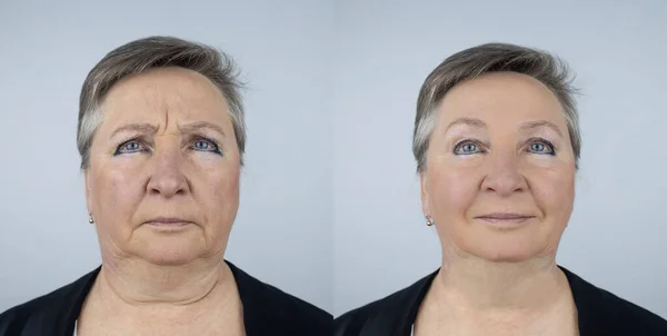 顔の整形外科医のレセプションで高齢女性 顔に年齢のしわの除去に関する相談 医者は彼がどんな手続きをするかを示す 変なしわだ 輪郭プラスチック — ストック写真