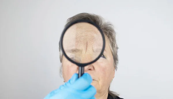 Ανώτερη Γυναίκα Στην Υποδοχή Ενός Πλαστικού Προσώπου Χειρουργού Διαβούλευση Σχετικά — Φωτογραφία Αρχείου