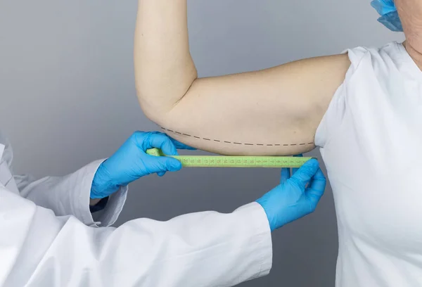 ブラチオプラスチック プラスチック製の腕 肘で皮膚をぶら下げています 高齢の女性は腕の外科医の問題領域を示しています 美容整形前の検査 — ストック写真