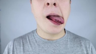 Kara dil. Bir adam yaralanmanın, ısırmanın ya da dilinin yanmasının sonuçlarını gösterir. Kısmen zarar görmüş. İç yaralanma tedavisi