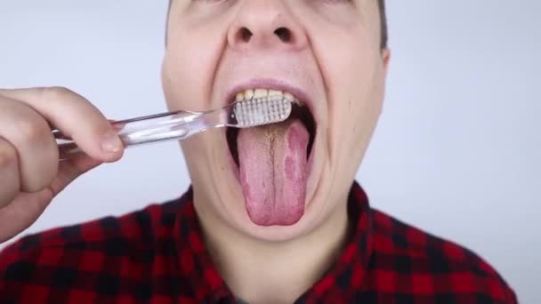 Saubere Zunge Nahaufnahme Eines Mannes Der Mit Einer Speziellen Zungenbürste — Stockvideo