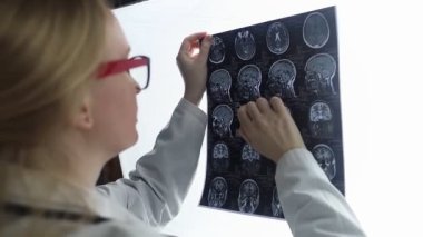 Epileptologist examines patient MRI and electroencephalogram. Concept treating epilepsy and helping people who suffer from this disease. Neurologist at work. Pathology of the brain. Seizure activity