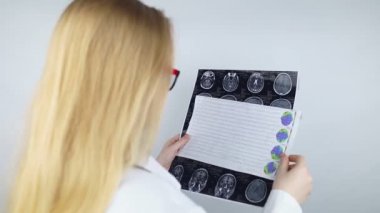 Epileptologist examines patient MRI and electroencephalogram. Concept treating epilepsy and helping people who suffer from this disease. Neurologist at work. Pathology of the brain. Seizure activity