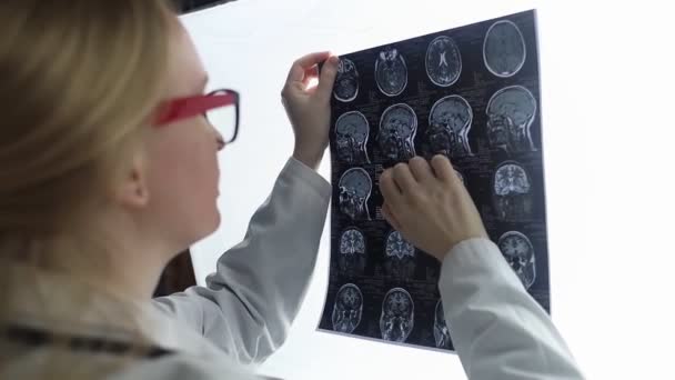 心エコー科医は患者のMriと脳波を検査する 概念はてんかんを治療し この病気に苦しむ人々を助ける 仕事中の神経科医 脳の病理学 押収活動 — ストック動画