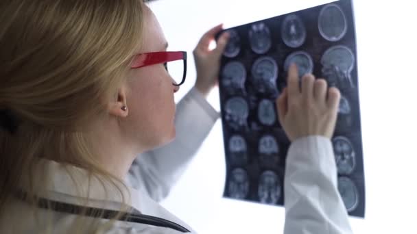 Επιληπτολόγος Εξετάζει Μαγνητική Τομογραφία Του Ασθενούς Και Ηλεκτροεγκεφαλογράφημα Έννοια Θεραπεία — Αρχείο Βίντεο