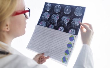 Epileptolog hasta MRI ve elektroansefalogramı inceliyor. Epilepsi tedavisi ve bu hastalıktan muzdarip insanlara yardım etme kavramı. Nörolog. Beynin patolojisi. Nöbet aktivitesi