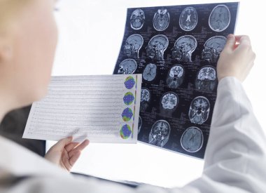 Epileptolog hasta MRI ve elektroansefalogramı inceliyor. Epilepsi tedavisi ve bu hastalıktan muzdarip insanlara yardım etme kavramı. Nörolog. Beynin patolojisi. Nöbet aktivitesi