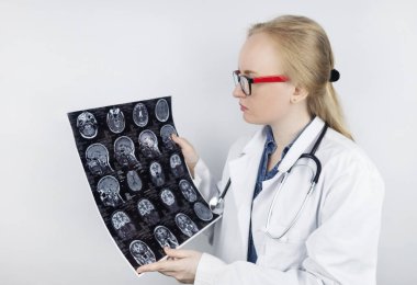 Epileptolog hasta MRI ve elektroansefalogramı inceliyor. Epilepsi tedavisi ve bu hastalıktan muzdarip insanlara yardım etme kavramı. Nörolog. Beynin patolojisi. Nöbet aktivitesi