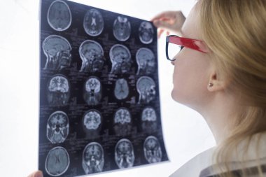 Epileptolog hasta MRI ve elektroansefalogramı inceliyor. Epilepsi tedavisi ve bu hastalıktan muzdarip insanlara yardım etme kavramı. Nörolog. Beynin patolojisi. Nöbet aktivitesi