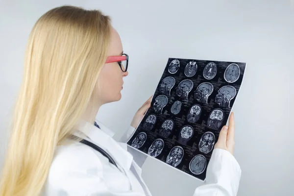 Mri Brain Neuropathologist Holds Picture Background Light Device See Pathologies — Stockfoto