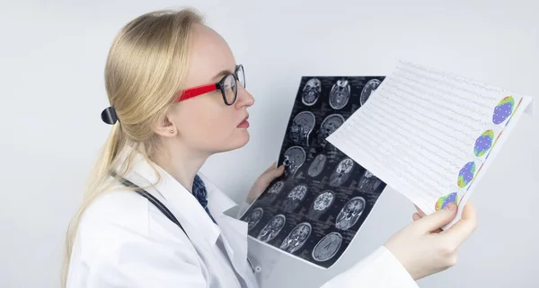 Epileptologista Examina Ressonância Magnética Paciente Eletroencefalograma Conceito Tratar Epilepsia Ajudar — Fotografia de Stock