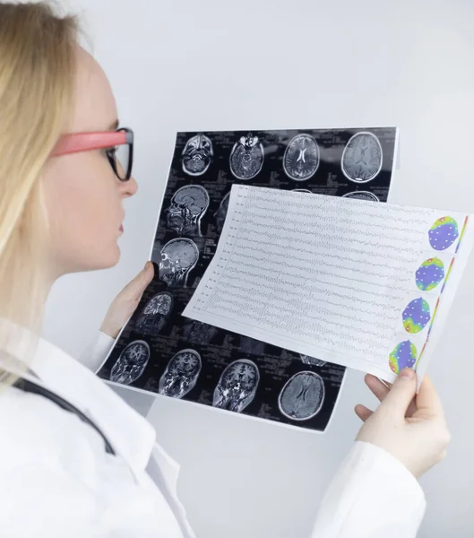 Epileptologist Examines Patient Mri Electroencephalogram Concept Treating Epilepsy Helping People — Stockfoto