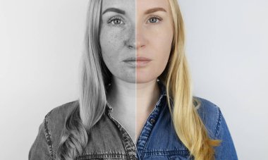 Deride morötesi ışınlar. Koruyucu krem testi. Soldaki deri korunmasız ve ultraviyole ışıktan kaynaklanan lekeler görülebilir. Sağda, özel ürünlerin koruması altında cilt temizdir..