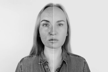 Deride morötesi ışınlar. Koruyucu krem testi. Soldaki deri korunmasız ve ultraviyole ışıktan kaynaklanan lekeler görülebilir. Sağda, özel ürünlerin koruması altında cilt temizdir..