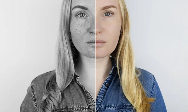 Ultravioletta Strålar Huden Skyddskräm Test Till Vänster Huden Oskyddad Och — Stockfoto