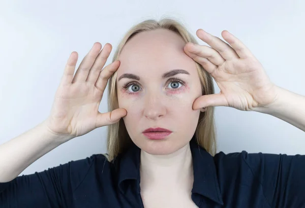 Alergia Cosméticos Menina Olha Para Espinhas Redor Seus Olhos Que — Fotografia de Stock