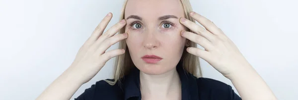 Allergia Kozmetikumokra Lány Megnézi Pattanásokat Szeme Körül Ami Mérgező Kozmetikumok — Stock Fotó