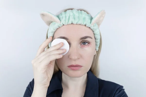 Alergia Cosméticos Menina Olha Para Espinhas Redor Seus Olhos Que — Fotografia de Stock