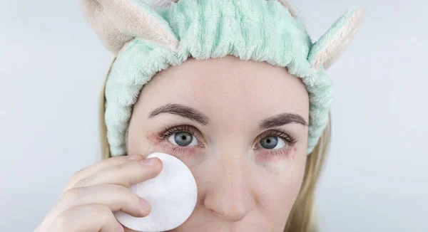 Allergie Voor Cosmetica Het Meisje Kijkt Naar Puistjes Rond Haar — Stockfoto