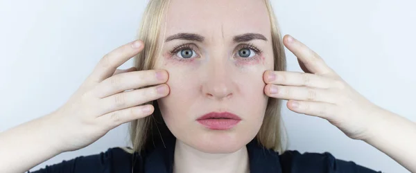 Allergie Voor Cosmetica Het Meisje Kijkt Naar Puistjes Rond Haar — Stockfoto