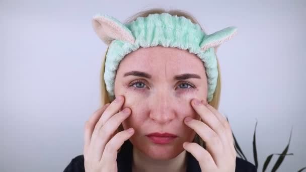 Allergy Cosmetics Girl Looks Pimples Her Eyes Appeared Using Toxic — Stock Video