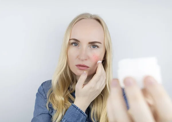 Allergie Gegen Kosmetika Mädchen Bekamen Akne Durch Eine Minderwertige Creme — Stockfoto