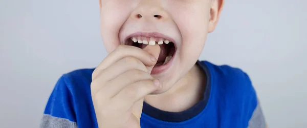 Вільні Дитячі Зуби Блондинка Торкається Молочного Зуба Руками Показує Він — стокове фото