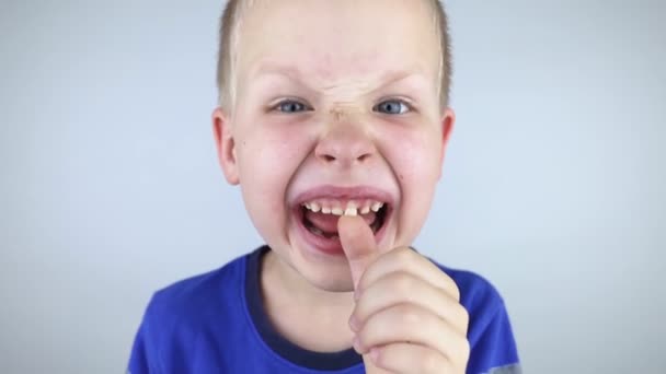Loose Baby Teeth Blond Boy Touches Milk Tooth His Hands — Video Stock