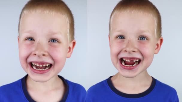 Loose Baby Tooth Left Boy Milk Tooth Loose Right Has — Stockvideo