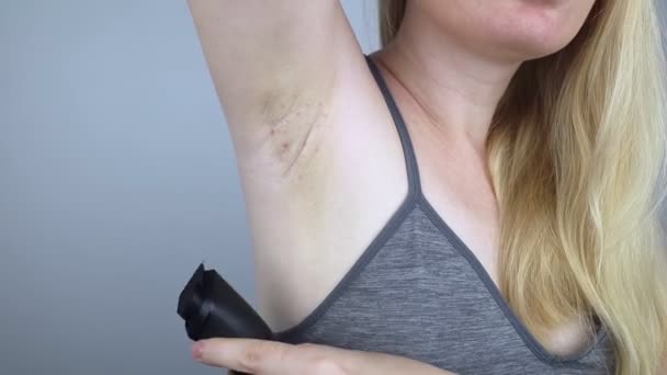 Armpit Rash Underarm Skin Irritation Blonde Girl Shows Irritation Skin — Vídeo de Stock