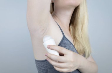 Armpit rash. Underarm skin irritation. Blonde girl shows irritation on the skin after using a razor, trimmer, deodorant or antiperspirant. Allergy or irritation. Acne or red spots