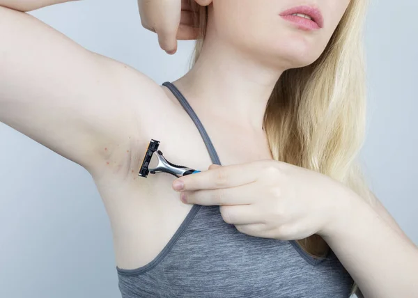 Armpit Rash Underarm Skin Irritation Blonde Girl Shows Irritation Skin — Foto de Stock