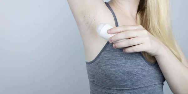 Armpit Rash Underarm Skin Irritation Blonde Girl Shows Irritation Skin — Zdjęcie stockowe