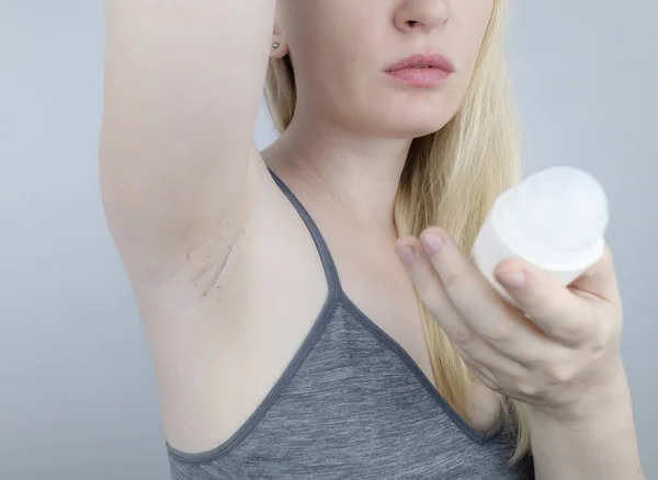 Armpit Rash Underarm Skin Irritation Blonde Girl Shows Irritation Skin — Stockfoto