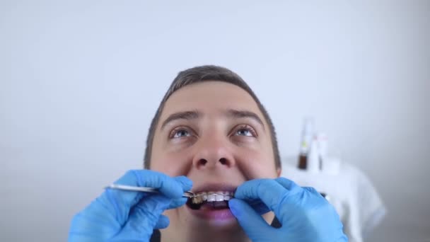 Instalación Aparatos Ortopédicos Puentes Placa Dental Para Corregir Los Dientes — Vídeos de Stock