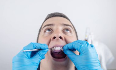 Diş telleri, köprüler ve dişlerini düzeltmek için takma bir plaka. Bir ortodontist düzgün olmayan bir çeneye bir parantez sistemi yerleştirir. Silikonlar ve gülümseme düzeltmeleri. Diş hekiminde çalışma kavramı