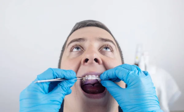 Instalação Aparelhos Pontes Uma Placa Dental Para Corrigir Dentes Ortodontista — Fotografia de Stock