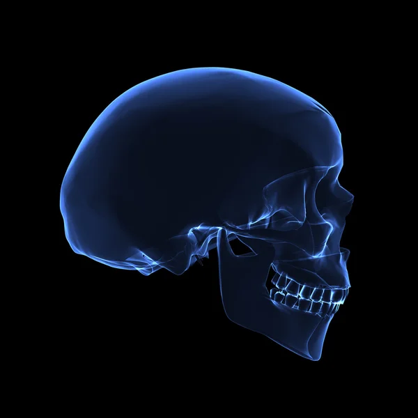 X ray skull — Stock Photo, Image