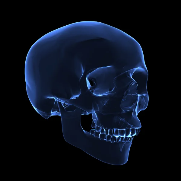 RTG czaszki — Zdjęcie stockowe