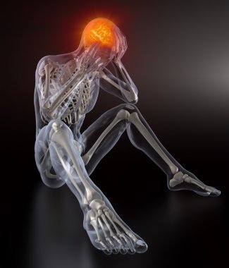 baş ağrısı kavramı