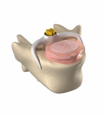 normal intervertebral disk, omurilik ve çekirdeği pulposus
